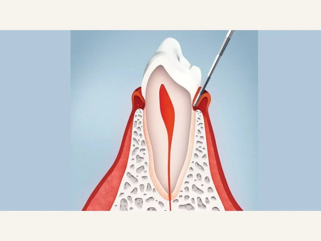 Dental hygiene, gum health assessment and care