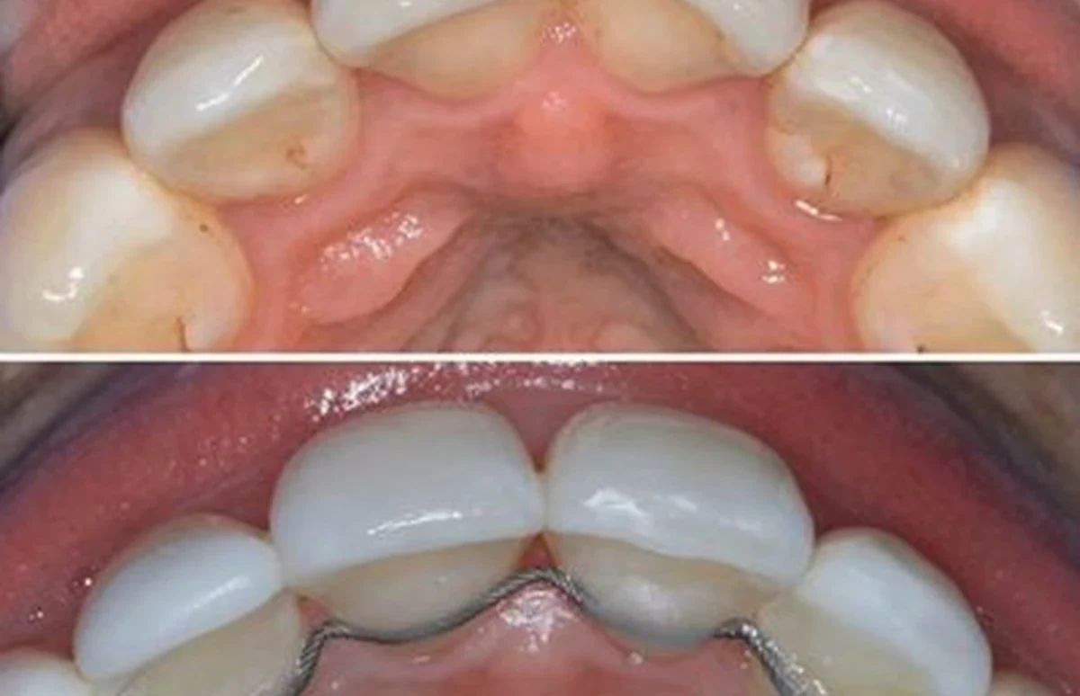 Cosmetic dentistry and carefully planned smile aesthetics