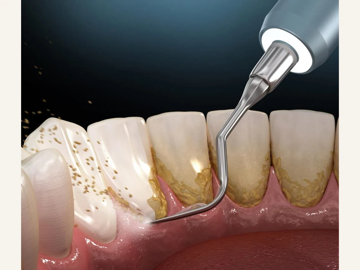 Dental hygiene, gum health assessment and care