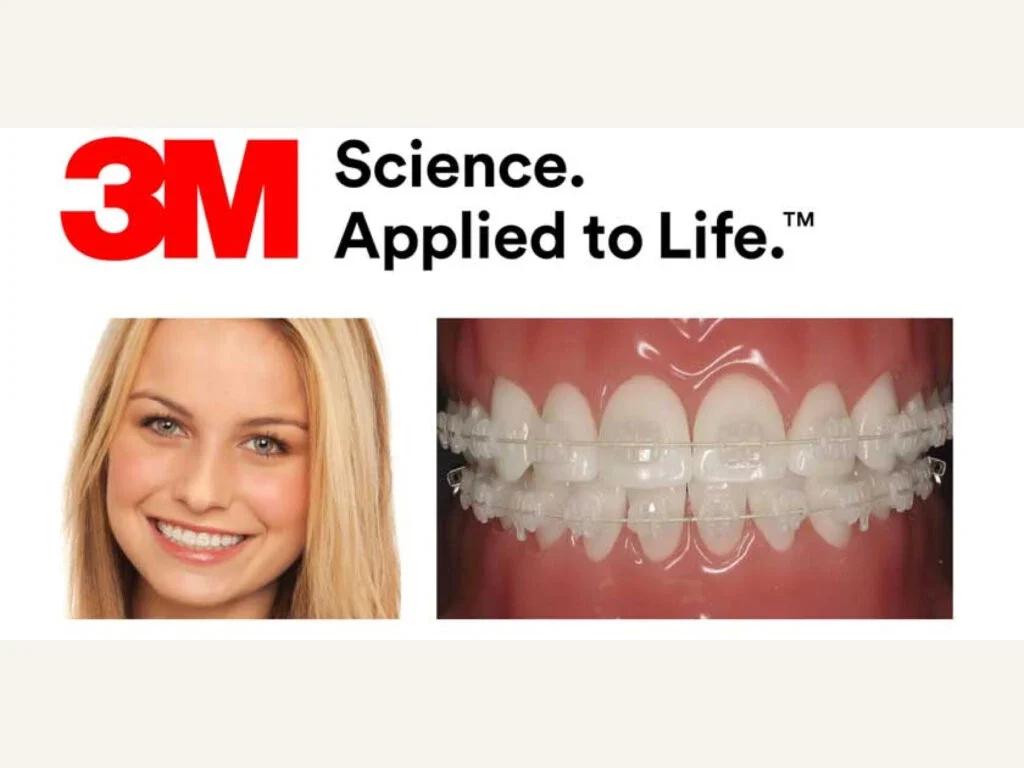 Braces and orthodontic treatment planning