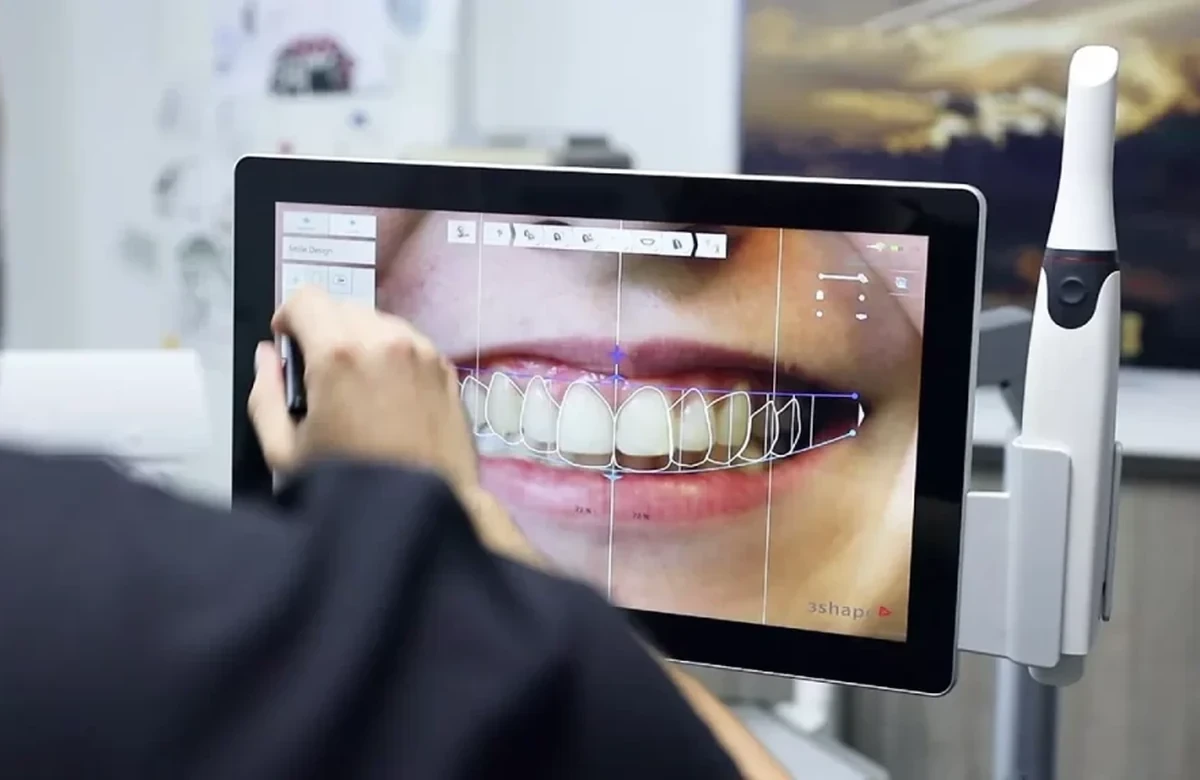 Smile proportions reviewed on a digital planning screen.