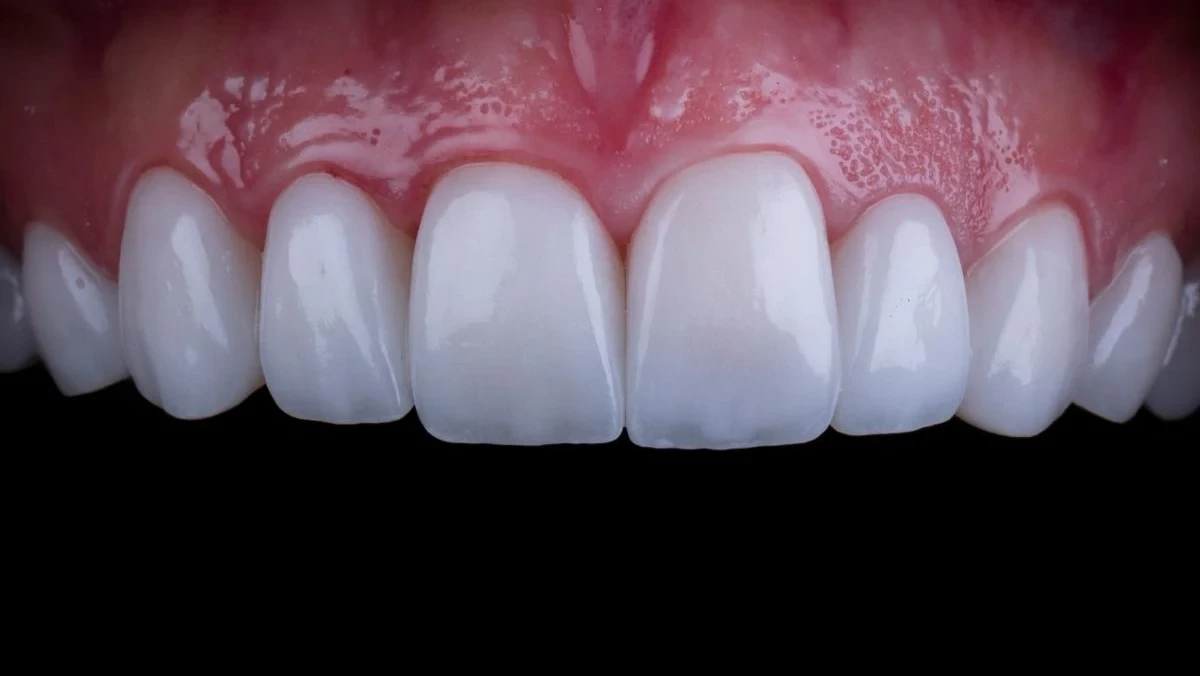 Designed for the face, not just the teeth.