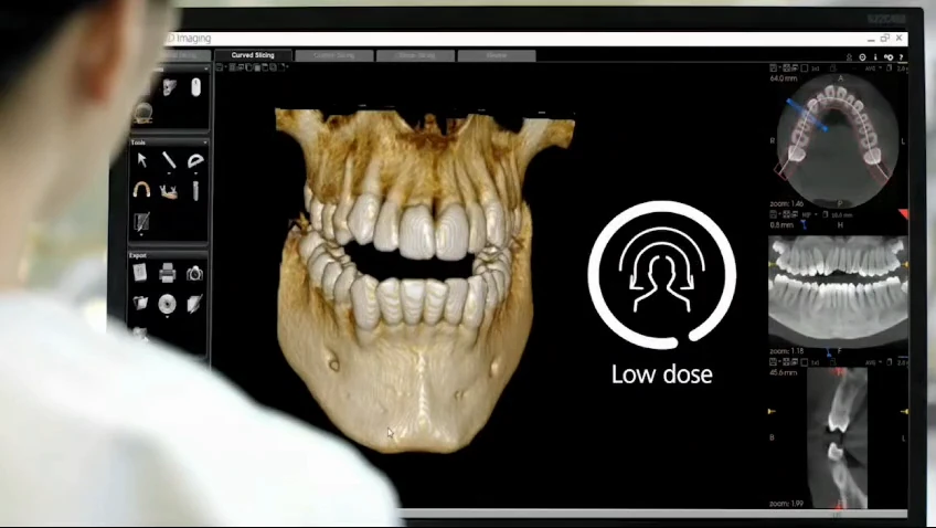 Detailed imaging for complex decisions.