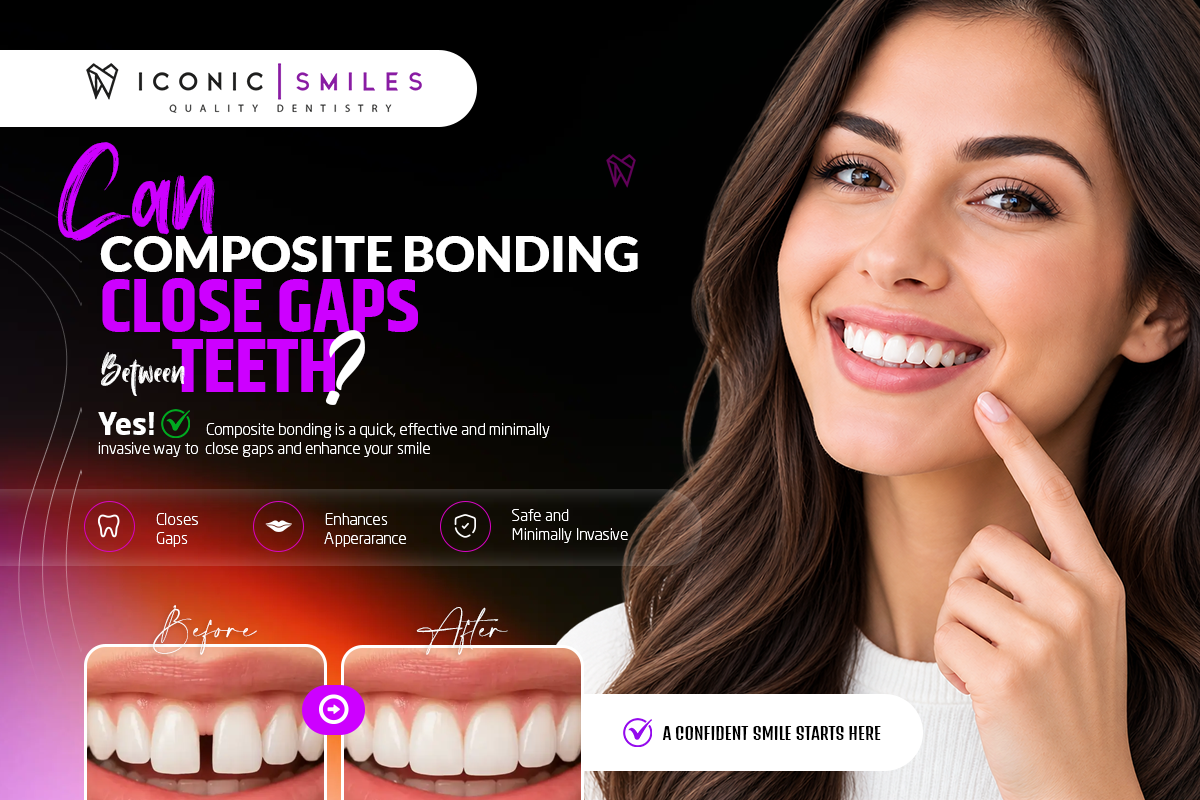 Composite Bonding for Small Gaps Between Teeth