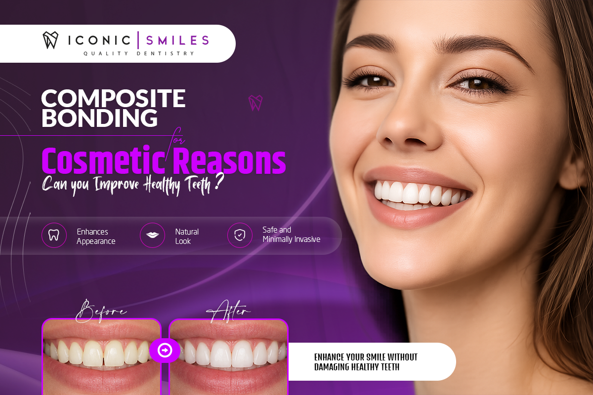 Composite bonding for cosmetic smile enhancement on healthy teeth