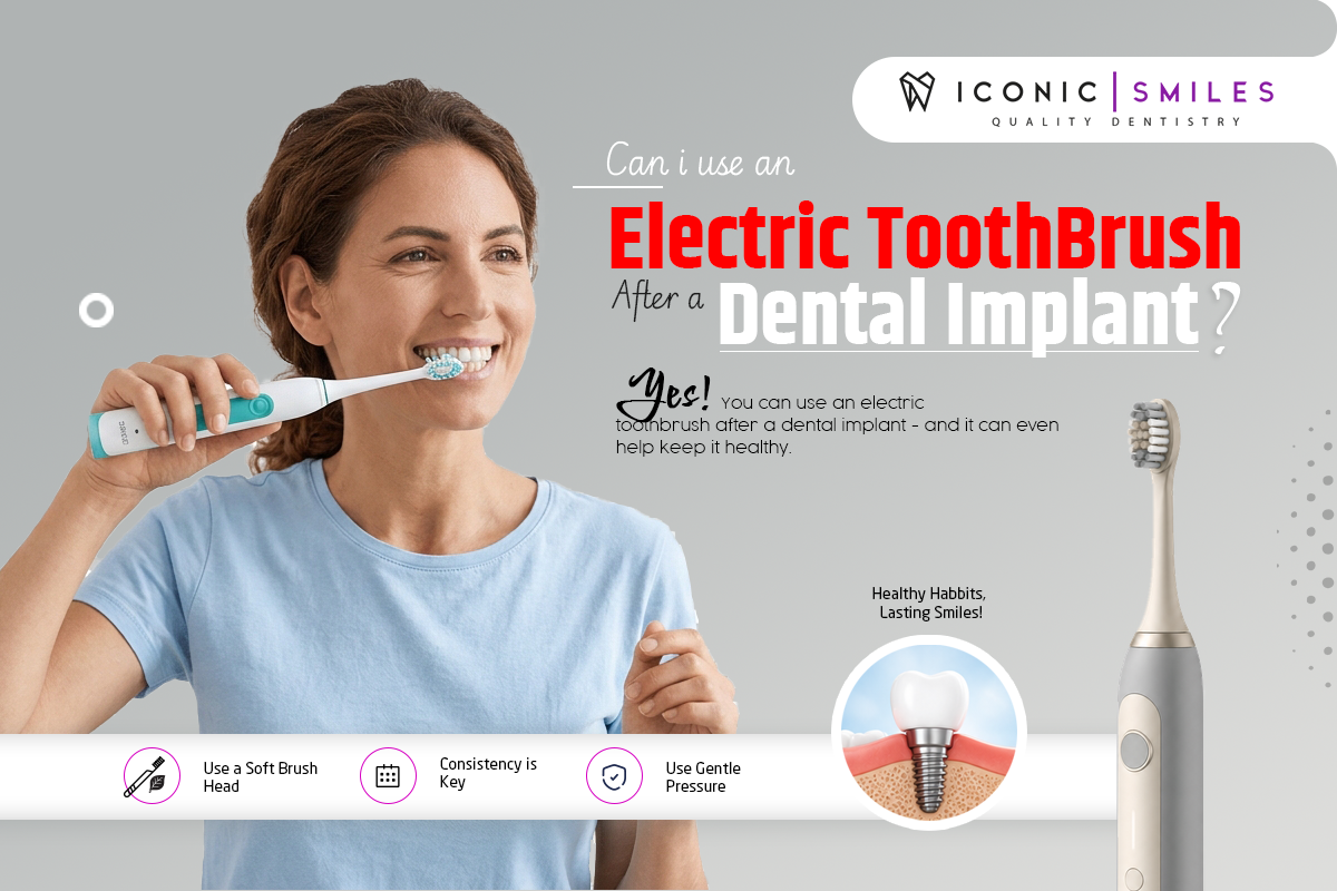 Using an electric toothbrush to clean around a healed dental implant