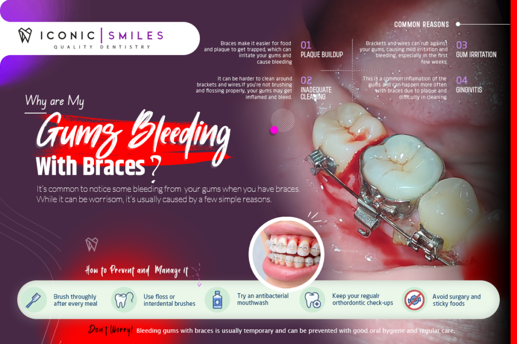 Why Are My Gums Bleeding With Braces