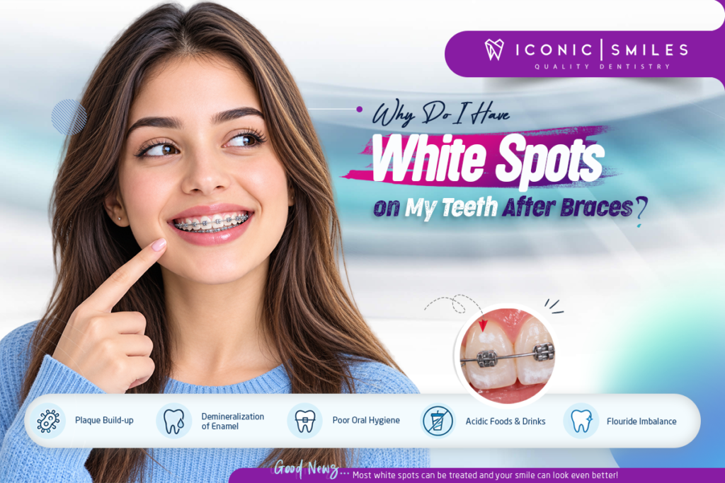 White Spots on My Teeth After Braces