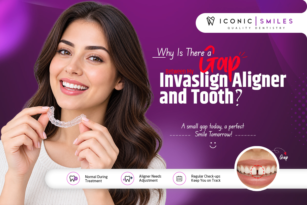 Gap Between My Invisalign Aligner and Tooth