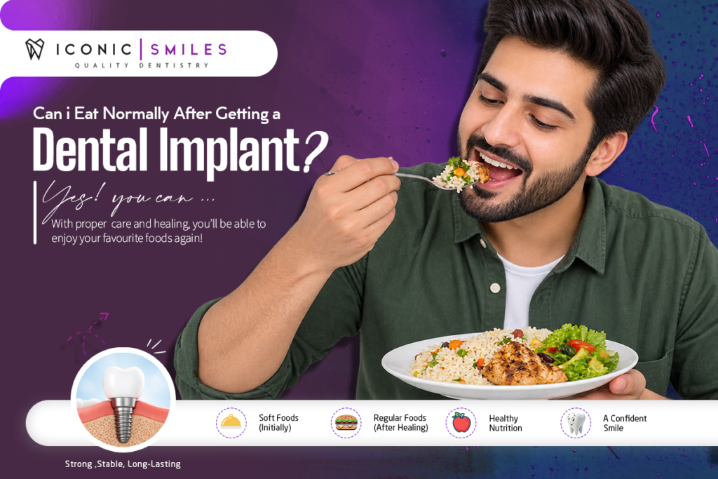 eating-after-dental-implant